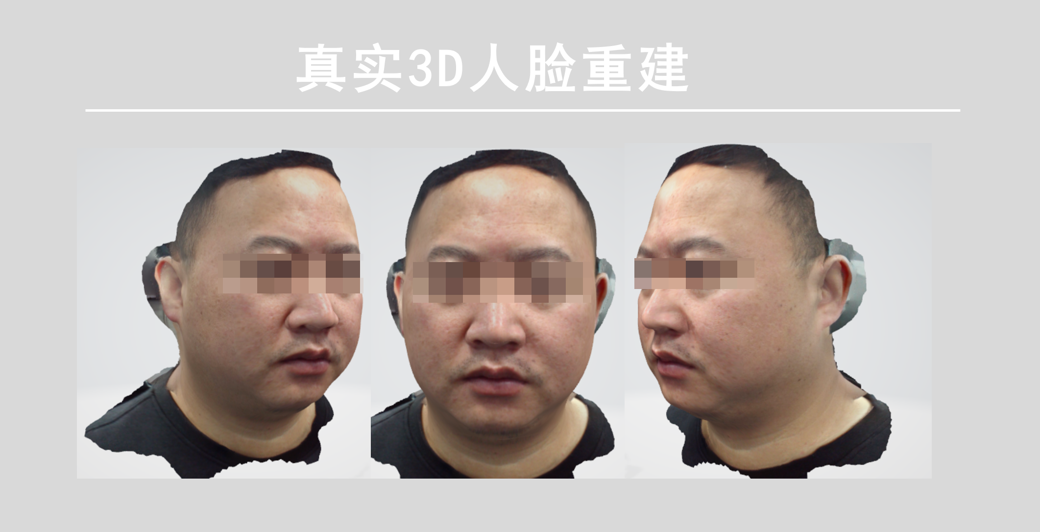 深度相機(jī)在模擬整形的作用